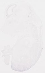 EMAGE:8477