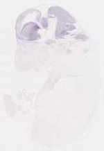 EMAGE:8547