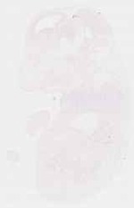 EMAGE:8622