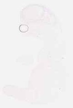 EMAGE:8695