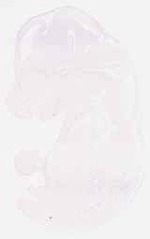 EMAGE:8695