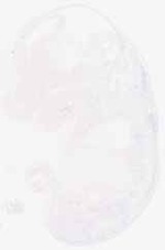 EMAGE:8817
