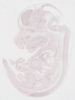 EMAGE:9200