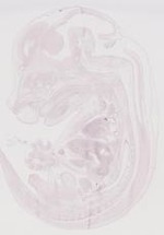 EMAGE:9683