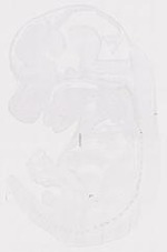 EMAGE:11252