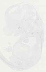 EMAGE:11273