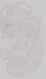 EMAGE:11364