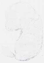 EMAGE:11393