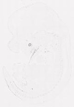 EMAGE:11393