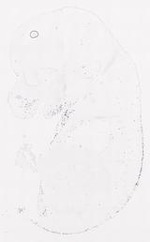 EMAGE:11393