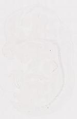 EMAGE:11395