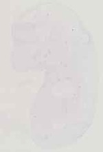 EMAGE:11441