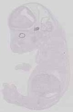EMAGE:11452