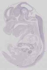 EMAGE:11452