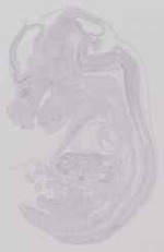 EMAGE:11452