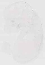 EMAGE:11485