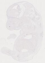 EMAGE:11489