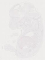 EMAGE:11489