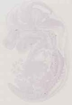 EMAGE:11495