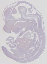 EMAGE:11502