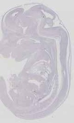 EMAGE:11542