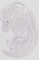 EMAGE:11579