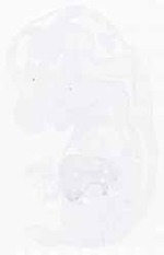 EMAGE:11622