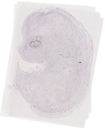 EMAGE:11639