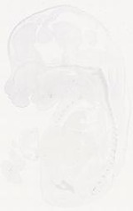 EMAGE:11661