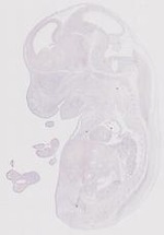 EMAGE:11672