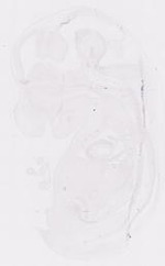 EMAGE:11672