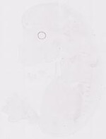 EMAGE:11672