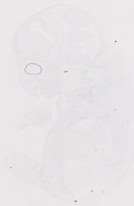 EMAGE:11673
