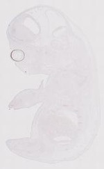 EMAGE:11674