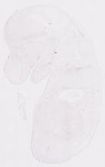 EMAGE:11674