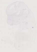 EMAGE:11681