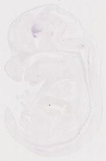EMAGE:11681