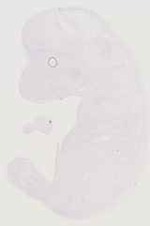 EMAGE:11712