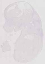 EMAGE:11713