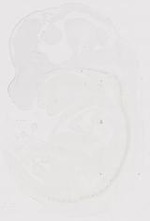 EMAGE:11737