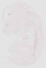 EMAGE:11759