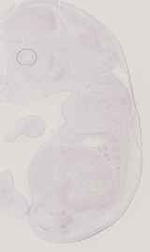 EMAGE:11764