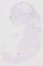EMAGE:11781