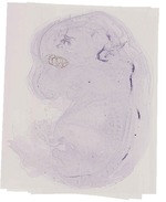 EMAGE:11782