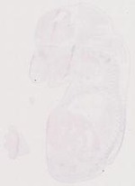 EMAGE:11808
