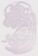 EMAGE:11809