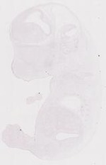 EMAGE:11813