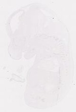 EMAGE:11813