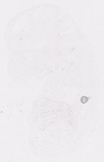 EMAGE:11816