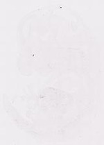 EMAGE:11816